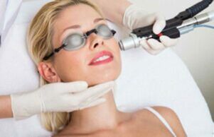 Procedemento de rexuvenecemento da pel facial con láser
